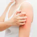 Алтернативни методи в лечението на атопичен дерматит