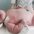 Жена роди 18-килограмово бебе