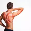 Пет често срещани причини за болката в гърба