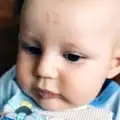 Бебе се роди с надпис 12 на челото