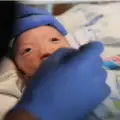 Бебе без нос се роди в САЩ