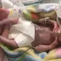 Тя е най-недоносеното бебе и не ѝ даваха шанс за живот