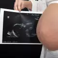 Линията на корема показва пола на бебето?