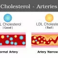 Какво е общ холестерол?