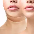 Кибела - техника за премахване на двойната брадичка