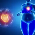 Връзката между сърдечните заболявания и добрите и лошите мазнини