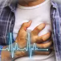 Кои са класическите симптоми на сърдечен удар
