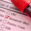 Причини за нисък хематокрит