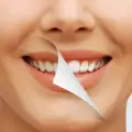 Трикове за по-бели зъби в домашни условия