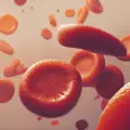 Сърповидно-клетъчни нарушения – какво трябва да знаем за тях?