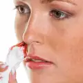 На какво се дължи кървенето от носа?