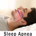 Обструктивна сънна апнея - какво представлява?
