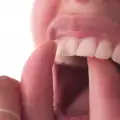 Разклатените зъби могат ли да се лекуват