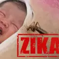 Зика – много по-опасна за бременните!