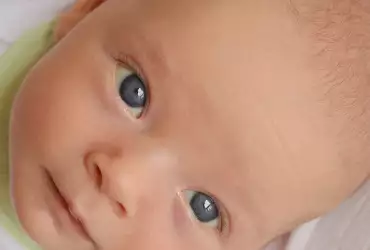 Какво трябва да знаем за жълтеницата при бебетата