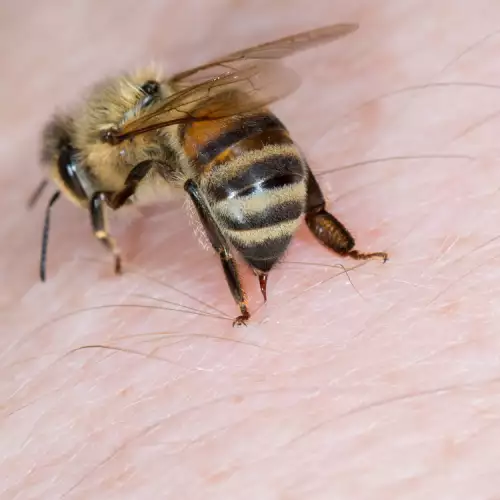 Какво да правим при ужилване от пчела или оса?