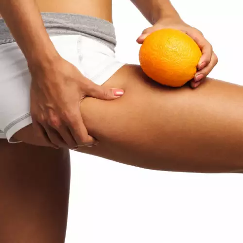 Основни причини за портокалова кожа