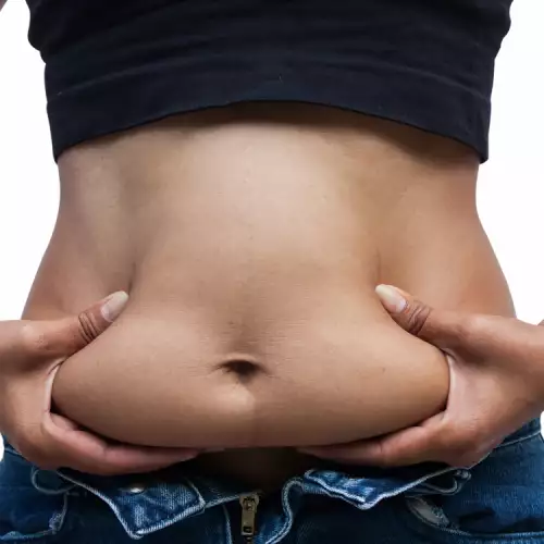 Brzo skidanje masnih naslaga u predelu stomaka