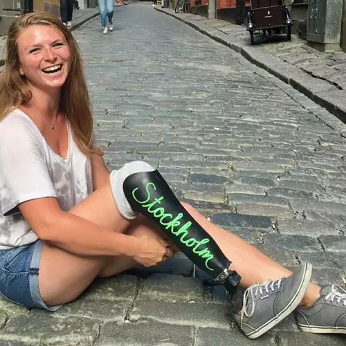 Момичето с един крак, което обиколи Европа с протезата си