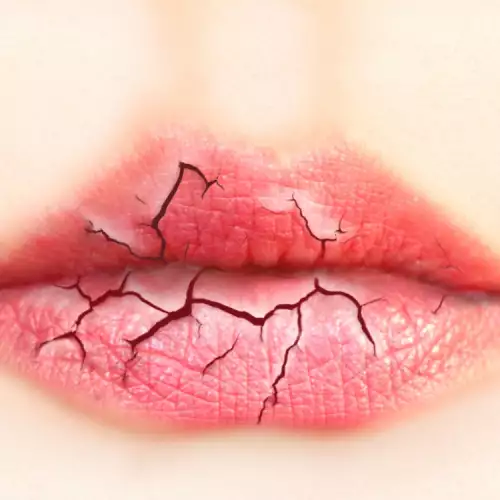 Как да спрете да си гризете устните?