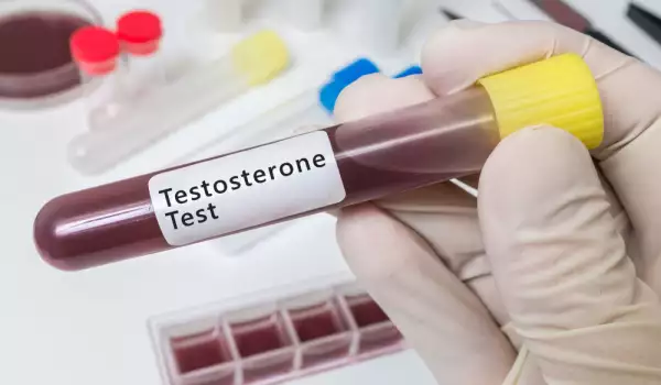 Понижаване хормона тестостерон при жени
