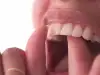 Прозрачен зъб